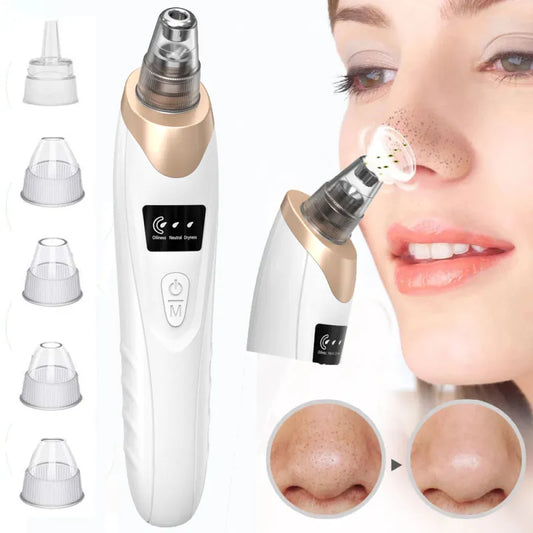 Skinova™⎪Electric blackhead remover