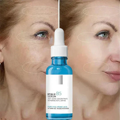 HyaluSerum™ V2 | Resist Aging with Drops